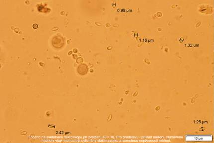 Obrázek Bienen, Mikrobiota und Nosema