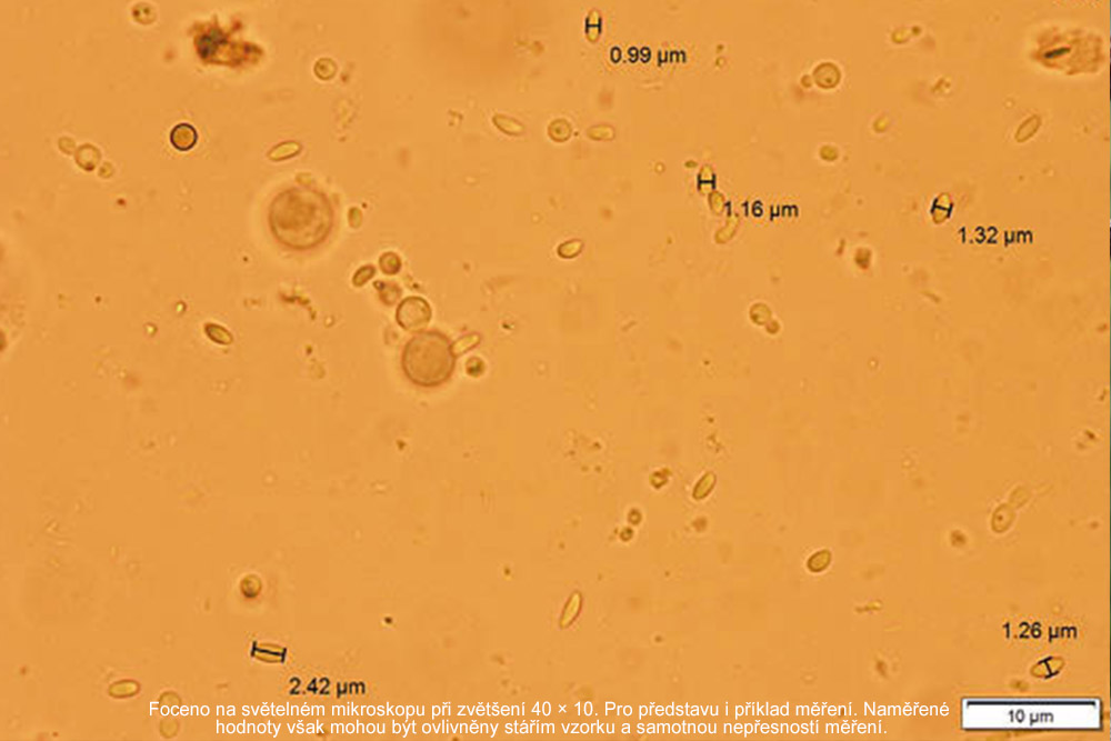Obrázek Bienen, Mikrobiota und Nosema